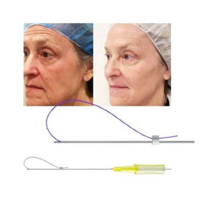 3D 4D 6D PDO Nâng mũi Chủ đề Tiêm căng da mặt Vít lốc xoáy đơn