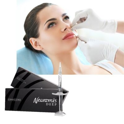 1ml Neuramis Dermal Filler cho điều trị bề mặt đến sâu trên khuôn mặt