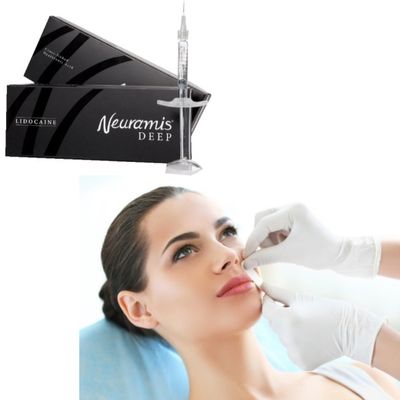 1ml Neuramis Dermal Filler cho điều trị bề mặt đến sâu trên khuôn mặt