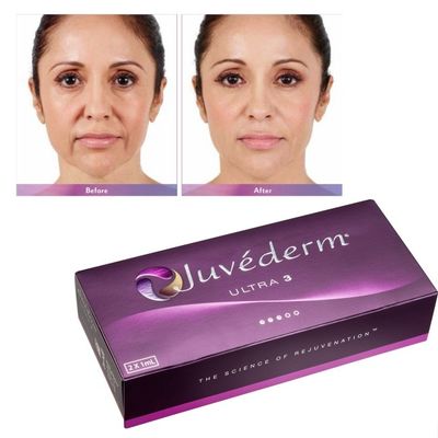 Hyaluronic Acid Juvederm Face Filler Gel da mịn màng và hoàn hảo