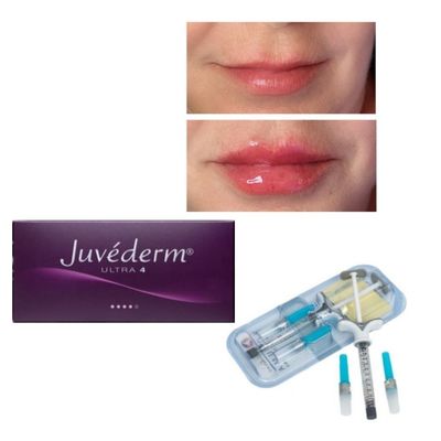 6-9 tháng Thời gian sử dụng Juvederm Dermal Filler Gel Cho mua trực tuyến và trong cửa hàng