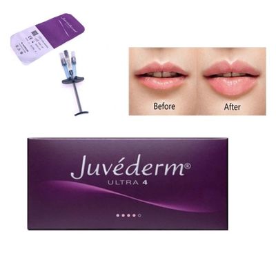 Allergan Juvederm Dermal Filler Injection Ultra4 Với Lido