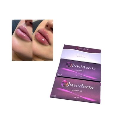 Tiêm Juvederm Voluma Cross Linked Dermal Filler