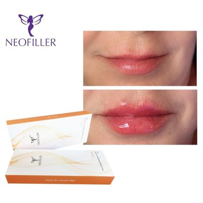 1ml axit hyaluronic Dermal Filler Gel tiêm 9-12 tháng Nổi trẻ tự nhiên Tăng cường khuôn mặt