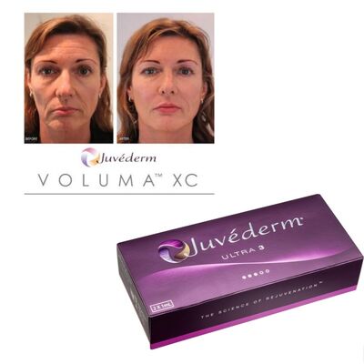 Chất làm đầy Juvederm dạng gel với nồng độ 20mg/ml, được thiết kế cho phẫu thuật thẩm mỹ và điều trị giảm nếp nhăn