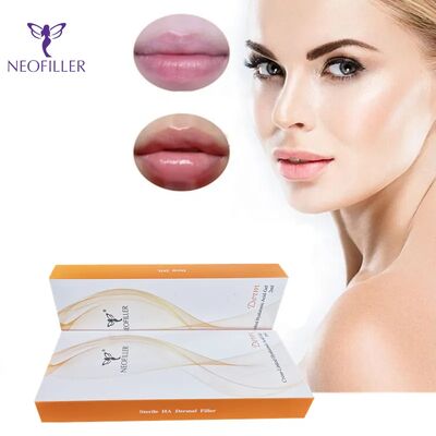 Axit hyaluronic liên kết chéo Filler da Tái trẻ hóa khuôn mặt Gel tiêm Tái sinh da tự nhiên Tăng cường