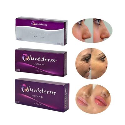 juvederm Chất làm đầy da có thể tiêm lâu dài Thời hạn sử dụng 2 năm