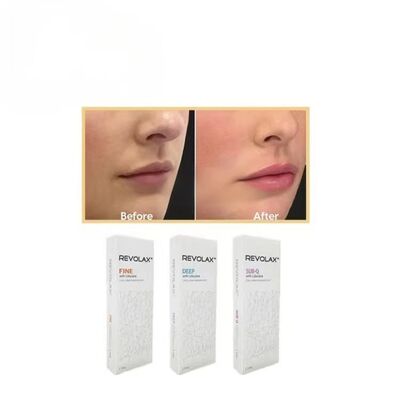 Bộ lấp da Sub-Q Revolax sâu mịn có kết cấu gel mịn và đàn hồi để phục hồi khối lượng khuôn mặt trông tự nhiên
