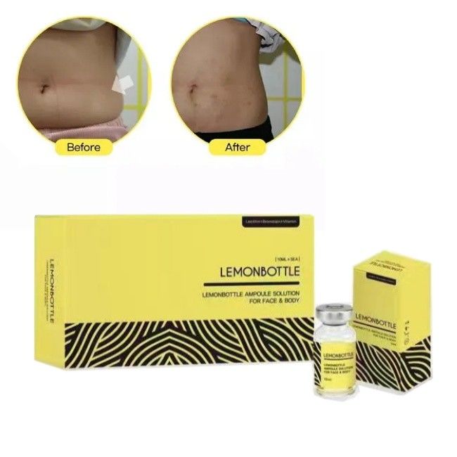 Liều xăng nồng độ cao trong chai để tiêm để hòa tan chất béo 5 chai X 10ml toàn thân