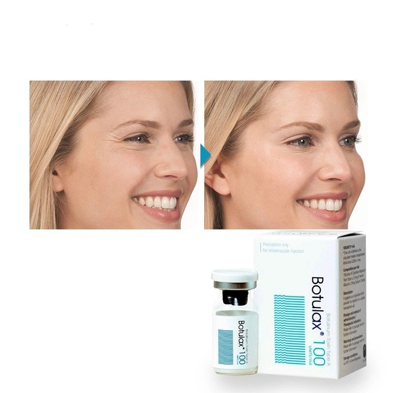 Allergan loại A thư giãn cơ bắp Botulax chống nhăn Mặt mỏng và vai