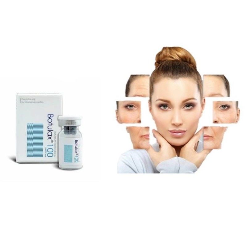 100 đơn vị Botulax đơn vị để điều trị nếp nhăn