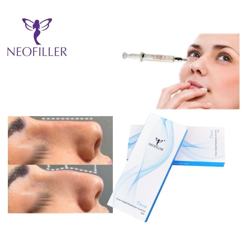 Neofiller Cross-linked Hyaluronic Acid Injection Gel với nồng độ 24mg/ml và tuổi thọ 9-12 tháng cho tiêm dưới da