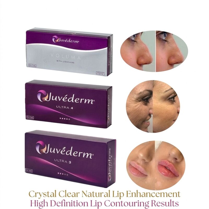 Khối lượng của ống tiêm 2 1ml mỗi hộp Juvederm Voluma Filler Safety Face Contouring Injectable Dermal Filler để tăng khối lượng