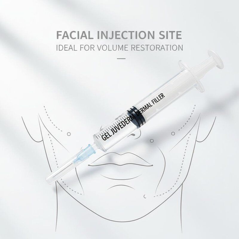 Gel Juvederm Dermal Filler 1ml Syringe Địa điểm tiêm khuôn mặt lý tưởng cho các thủ tục trẻ hóa khuôn mặt và khôi phục khối lượng
